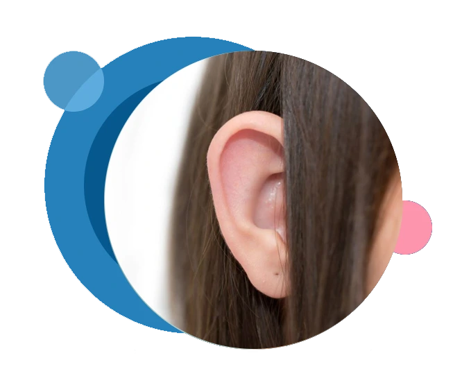 Prominent Ear Correction (Otoplasty)