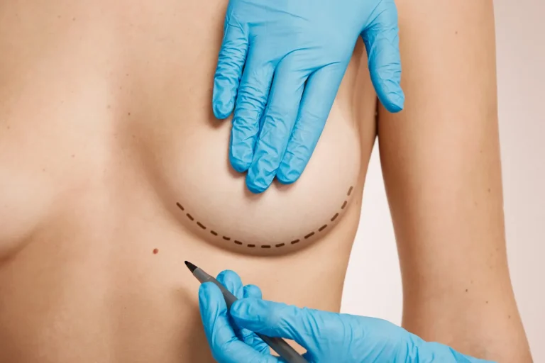Dealing With the Aesthetic Effects of Boob Job Scars