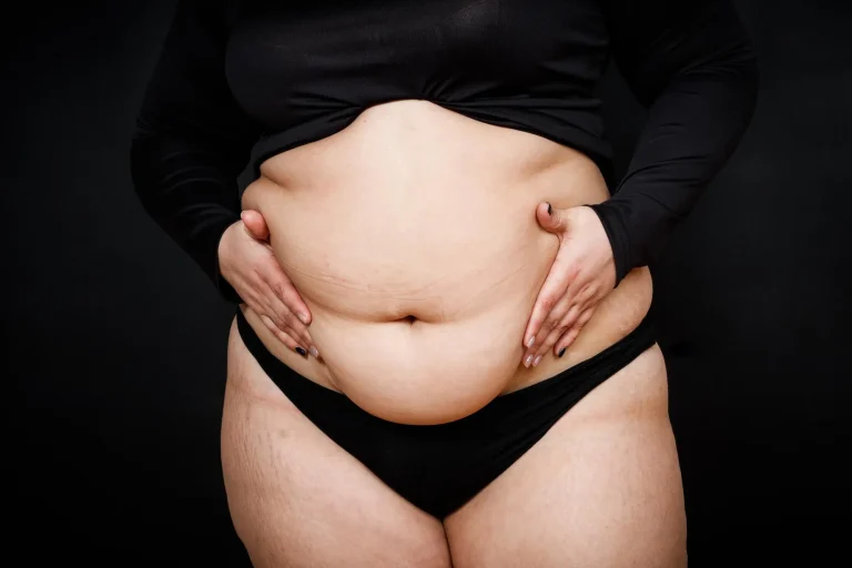 What you need to know about liposuction ?