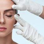 Procedures That Can Be Combined with Eyelid Aesthetic Surgery