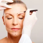 What Is a Facelift? Who Is It Suitable For?