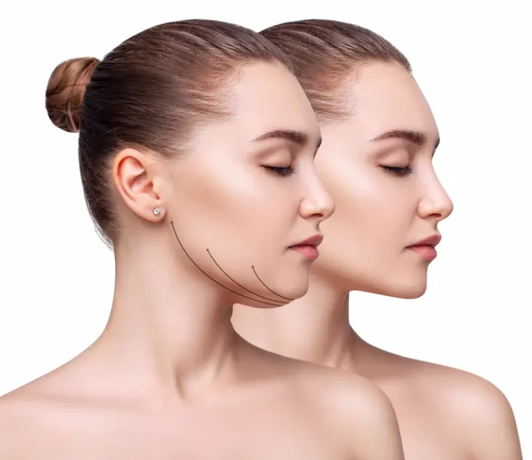 Risks and Possible Complications of Double Chin Aesthetics