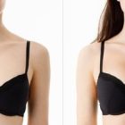 Breast Augmentation and Lift vs. Non-Surgical Alternatives: Which Option Is Right for You?