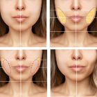 When Do Buccal Fat Removal (Bichectomy) Results Become Visible? Recovery Process and Final Outcome