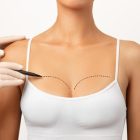 What is Breast Augmentation? Who is it Suitable For?