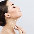 Double Chin Surgery Costs and Pricing: What Factors Affect the Cost?