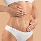 Tummy Tuck (Abdominoplasty) Prices and Costs: What Do They Depend On?
