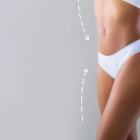 Vaser Liposuction Recovery Process: What to Expect and Essential Aftercare Tips